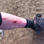 pedal to shin feels so good hitting your shins on the pedals